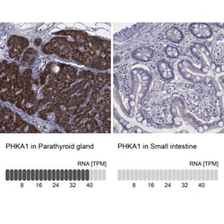PHKA1 Antibody, Novus Biologicals 0.1mL; Unlabeled:Antibodies, Polyclonal